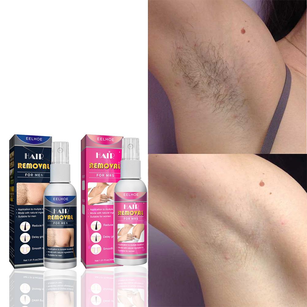 1/2PCS 여성을위한 슈퍼 자연 무통 영구 헤어 리무 - Hair Care Lotion 리뷰 및 가격