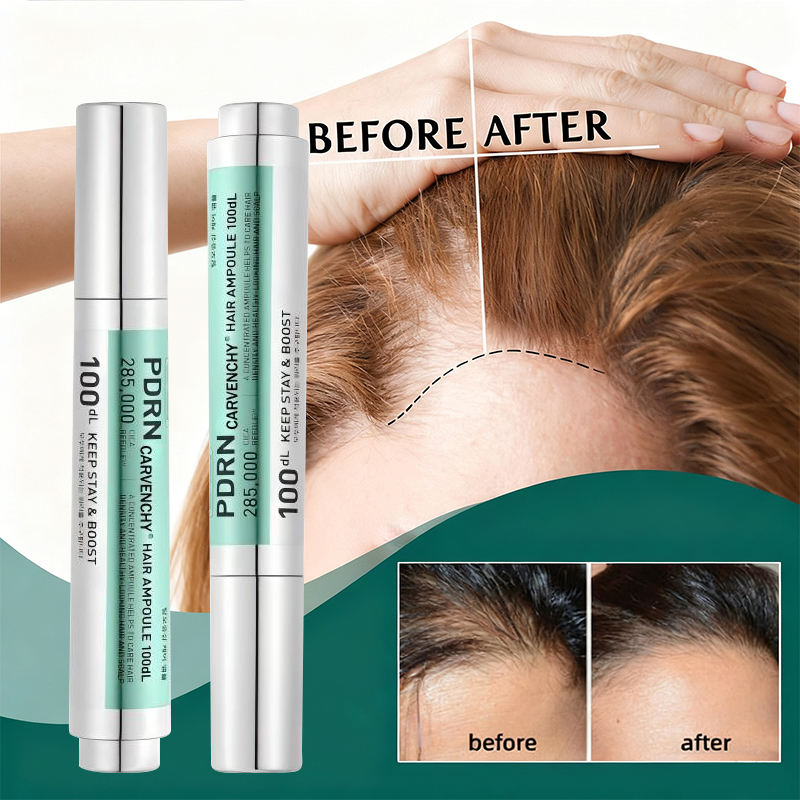PDRN 한국 두피 에센스 영양 공급 진정 케어 탈모  - Hair Care Korean Products 리뷰 및 가격