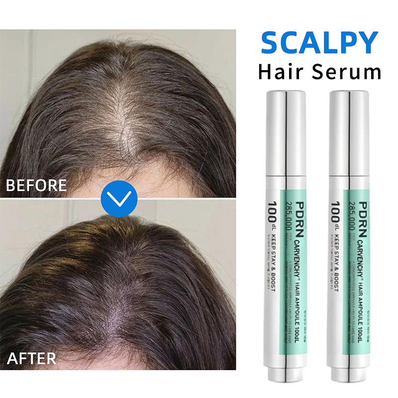 PDRN 한국 두피 에센스 영양 공급 진정 케어 탈모  - Hair Care Korean Products 리뷰 및 가격